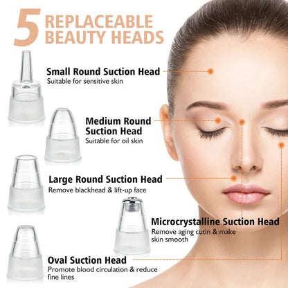 Electric Blackhead Remover – Vacuum Acne & Pore Cleaner